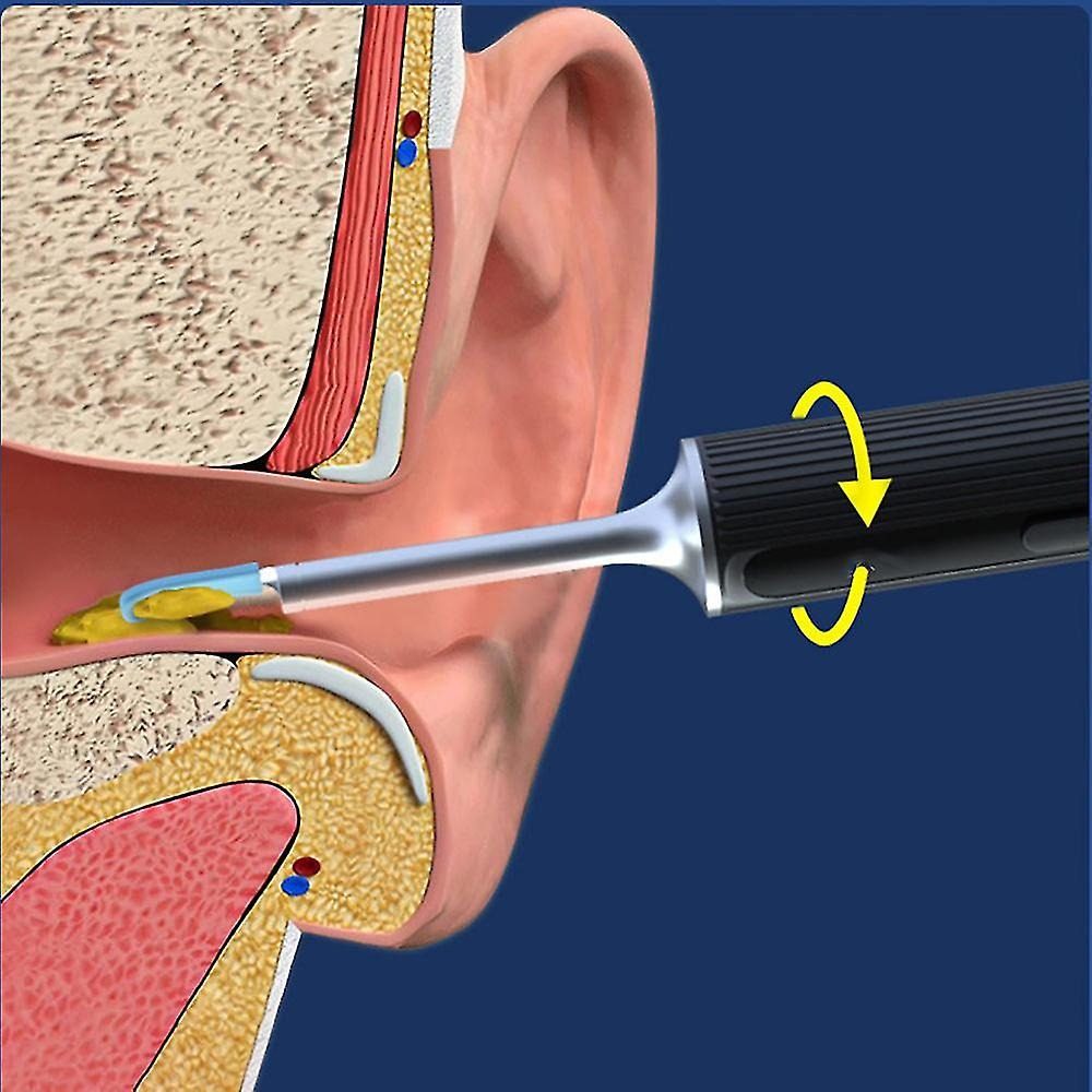 7MD Ear Cleaner Portable Visual Wifi Ear Wax Cleaner Endoscope With Rechargeable Battery | MX8 |