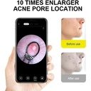 7MD Ear Cleaner Portable Visual Wifi Ear Wax Cleaner Endoscope With Rechargeable Battery | MX8 |