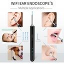7MD Ear Cleaner Portable Visual Wifi Ear Wax Cleaner Endoscope With Rechargeable Battery | MX8 |